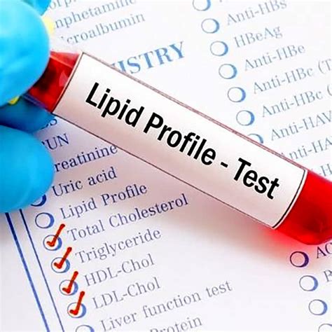 lipid profile test package|lipid profile test at home.